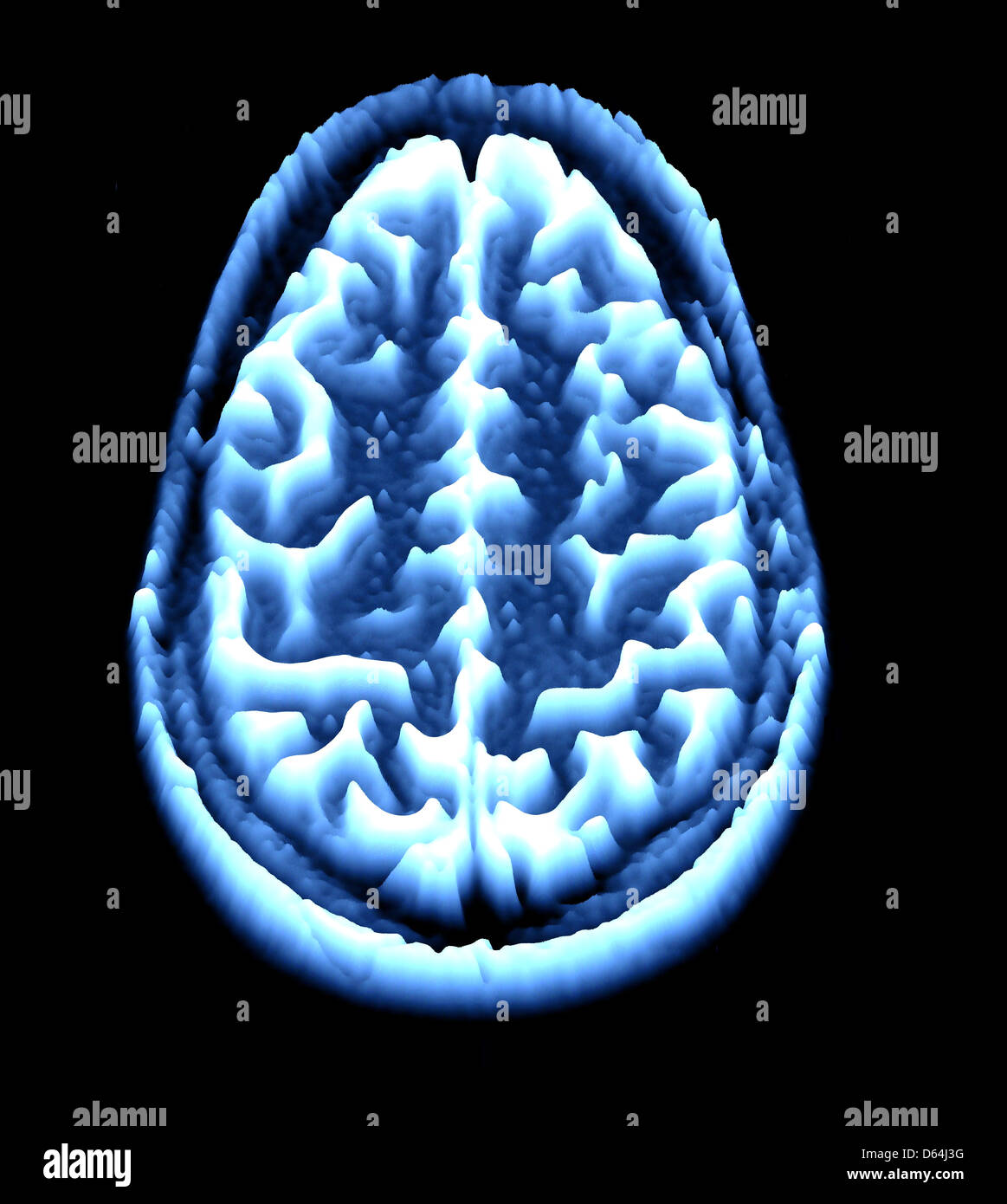 Gehirn-Scan, MRI Scan, heightmap Stockfoto