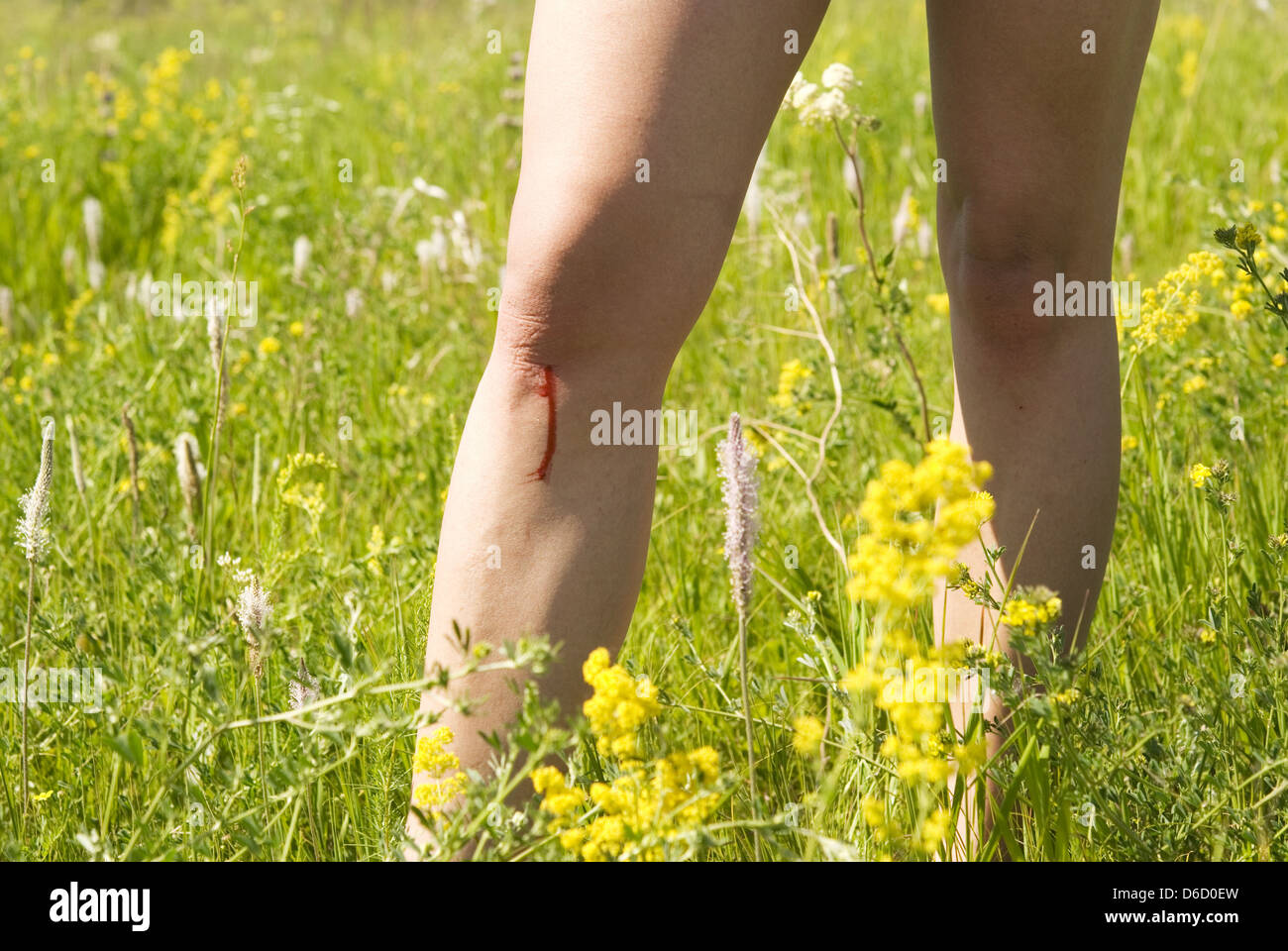Infizierte wunde behandeln Fotos und Bildmaterial in hoher Auflösung Alamy