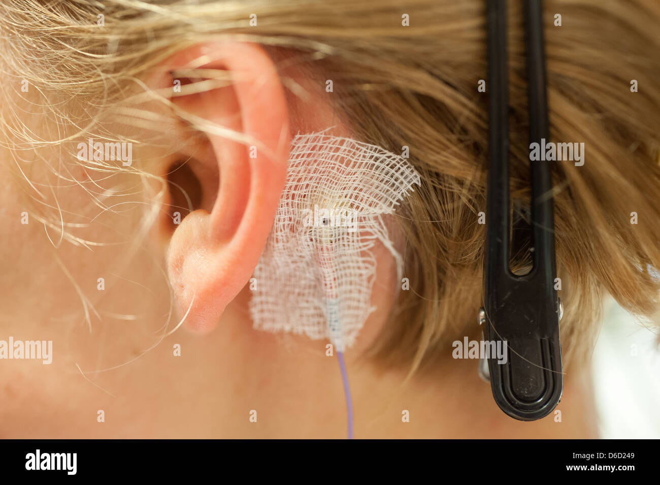 Berlin, Deutschland, montiert Sensorkabel hinter ein Ohr im Schlaflabor Stockfoto