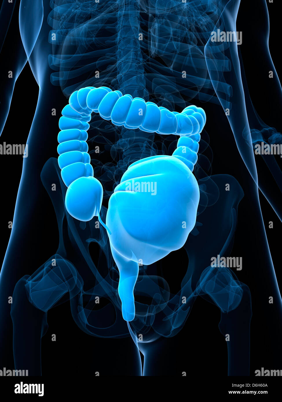 Toxische Megacolon, artwork Stockfoto, Bild 55696938 Alamy
