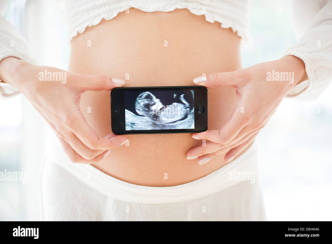 Schwangere Frau und Baby-scan Stockfoto