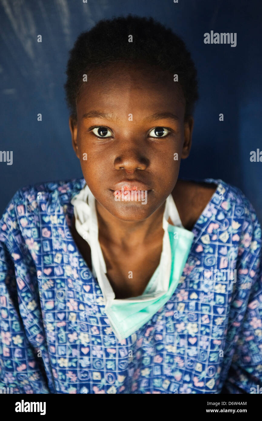 TB HIV leidende, Krankenhaus-Patienten nach dem Erdbeben im Januar 2010, AKH, Port au Prince, Haiti, Caribbean Stockfoto