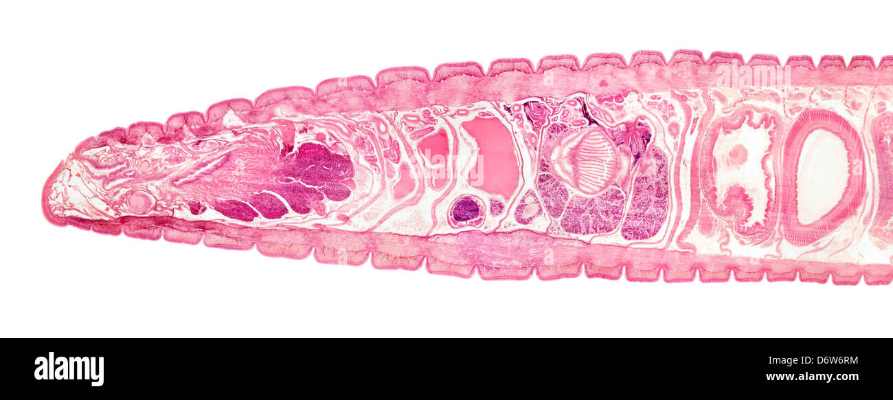 Regenwurm Hellfeld Mikrophotographie, Lumbricus Annelida Wenigborster, gebeizt Längsschnitt zeigt interne Strukturen Stockfoto