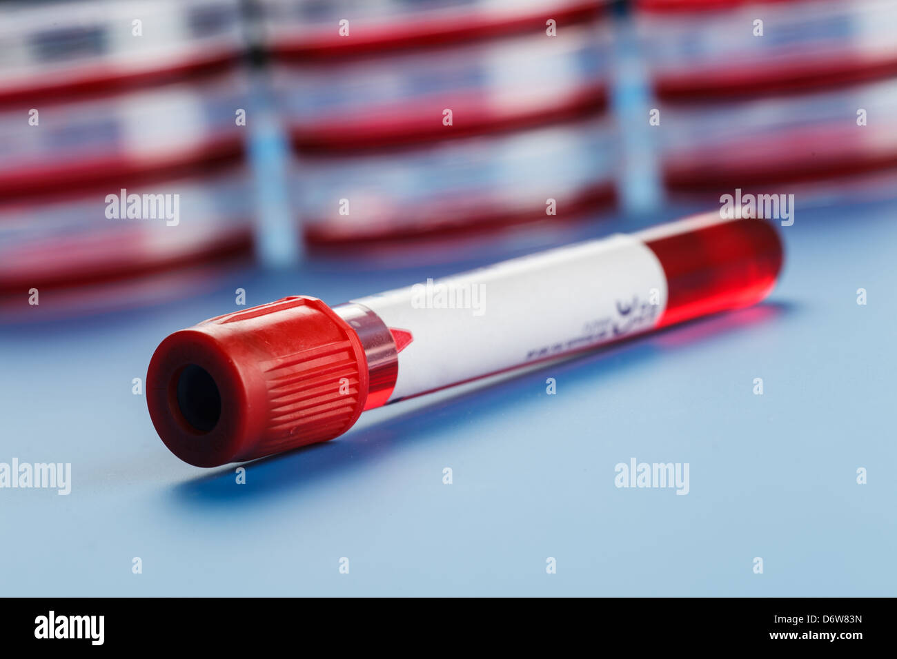 Blutprobe in einem Reagenzglas Vacutainer Stockfoto