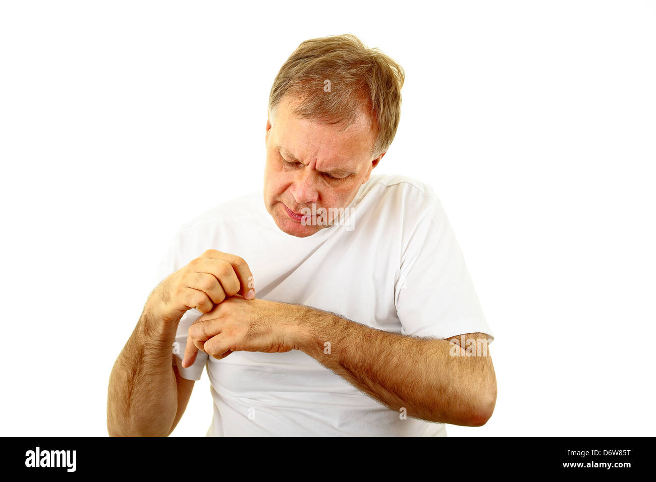 erwachsenen Mannes kratzen die juckende hand Stockfoto