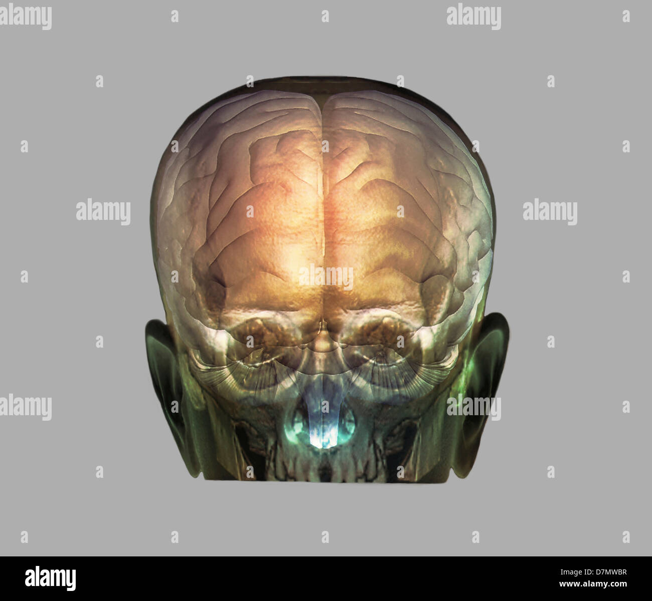 Menschenkopf, 3D CT und MRI-scans Stockfoto