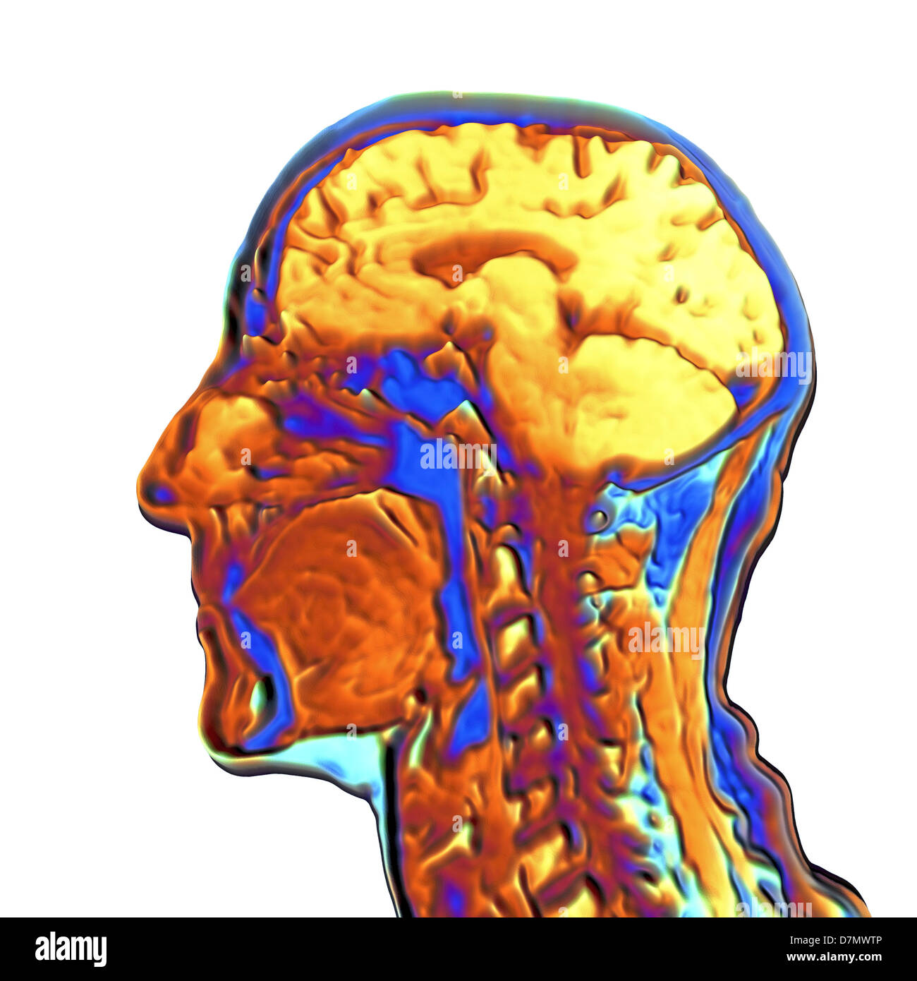 Farbige MRT-Untersuchung des menschlichen Kopfes Stockfoto