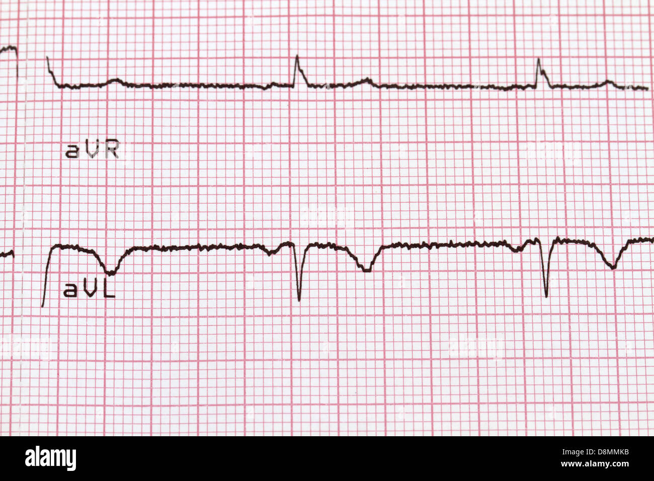 EKG auf Papier Stockfoto