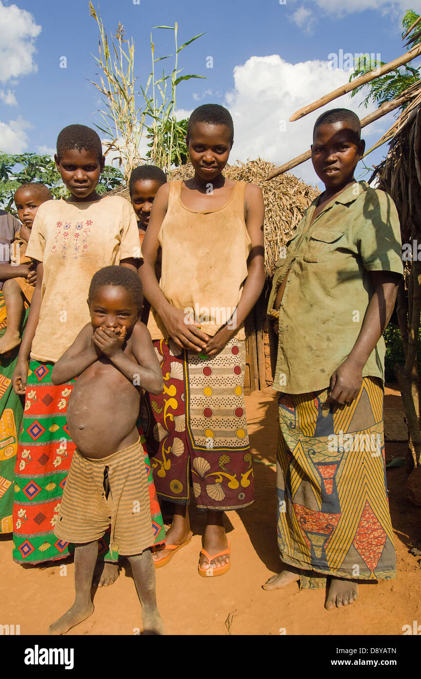 Eine Familie neben der Straße leben in Armut Kind mit offensichtlichen Würmer afrikanische burundischen Kinder östlichen Afrika weibliche Frauen Mädchen Stockfoto