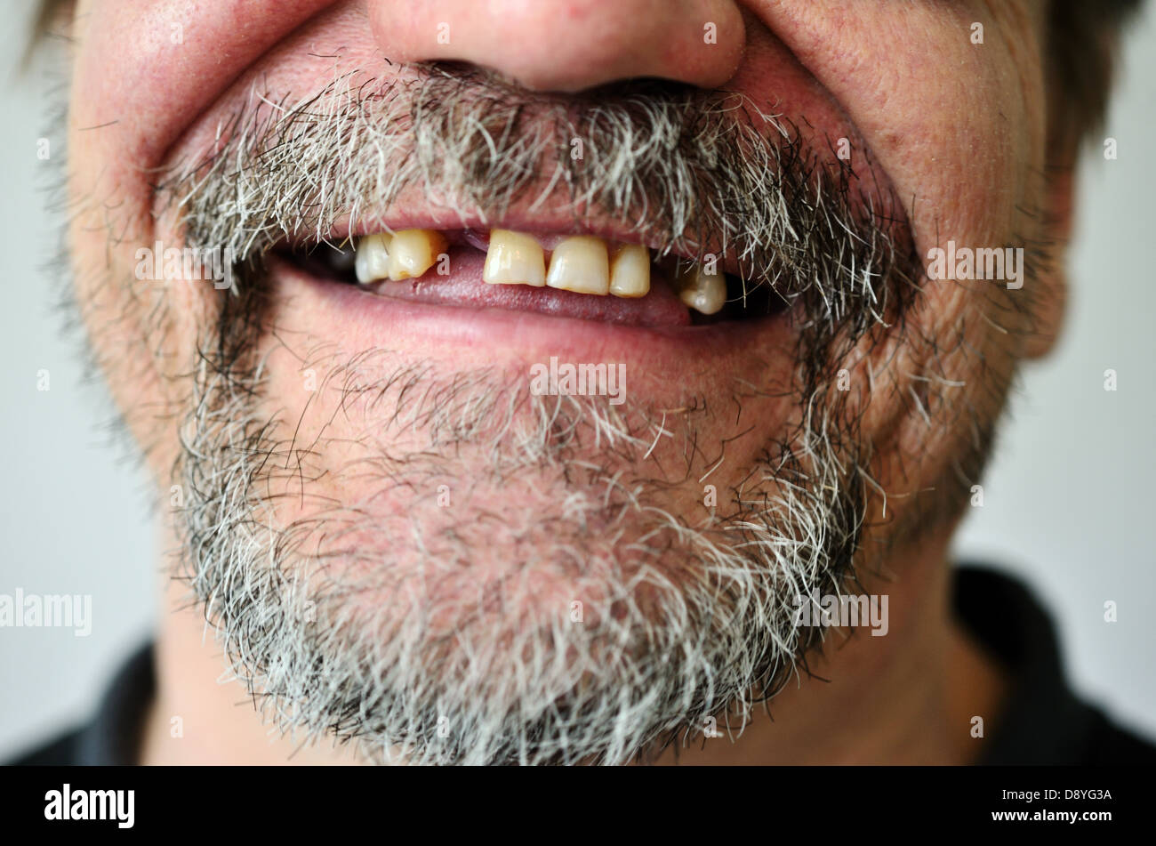 Teil des Gesicht eines Mannes mit einem zahnlosen Lächeln Stockfoto
