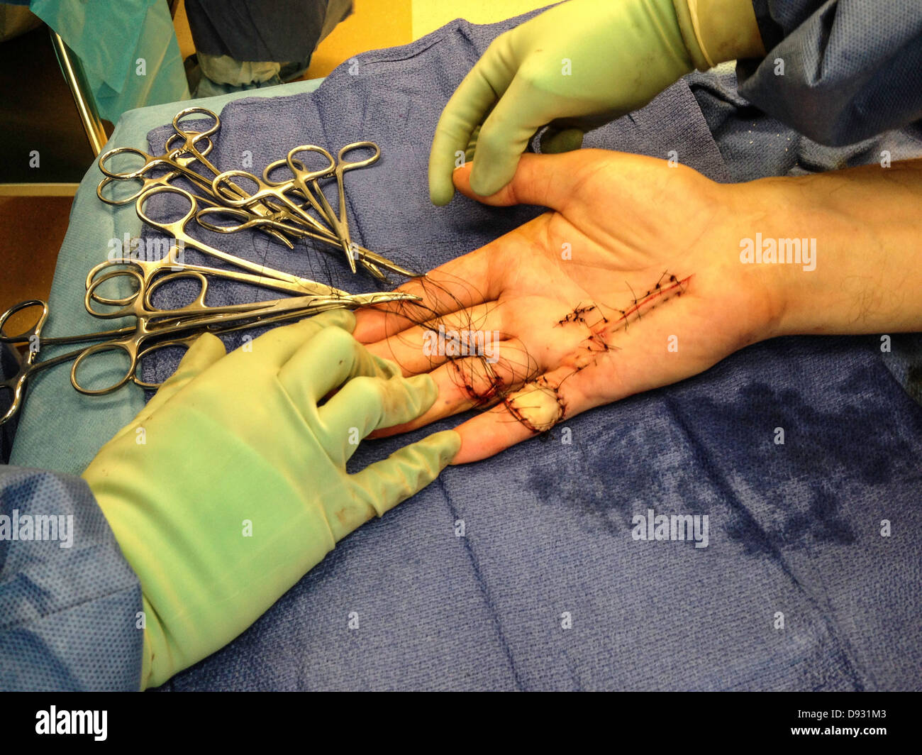 Kaukasische Frau mit Chirurgie - Smartphone-aufgenommenes Stockfoto