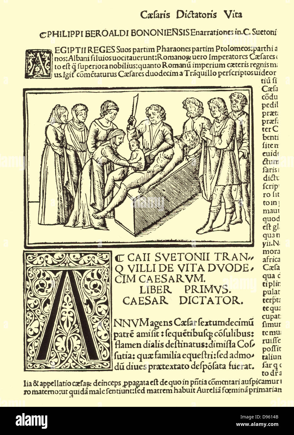 Geburt von Julius Cäsar (100-44 v. Chr.) c per Kaiserschnitt. Von Filippion beroaldo's (1453-1505) Edition von Leben Seutonius' der Cäsaren", die die Legende von Caesar's Geburt wiederholt. Stockfoto