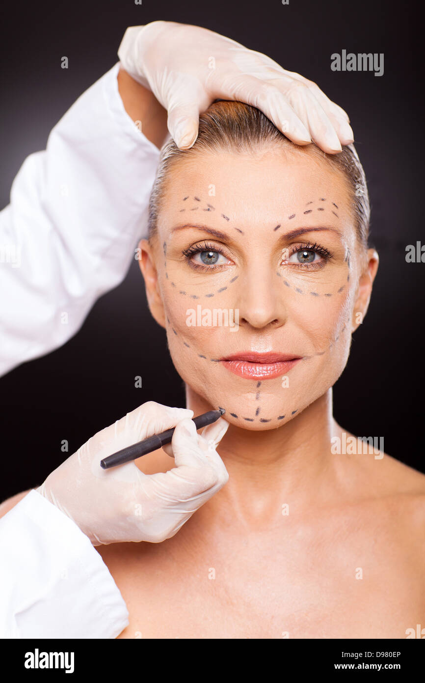 Arzt, Kennzeichnung senior Frau Gesicht für plastische Chirurgie Stockfoto