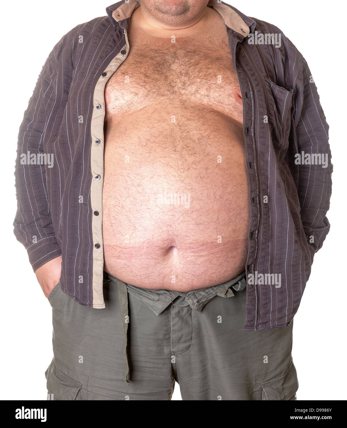 Dicker Mann mit einem dicken Bauch, close-up Teil des Körpers Stockfoto