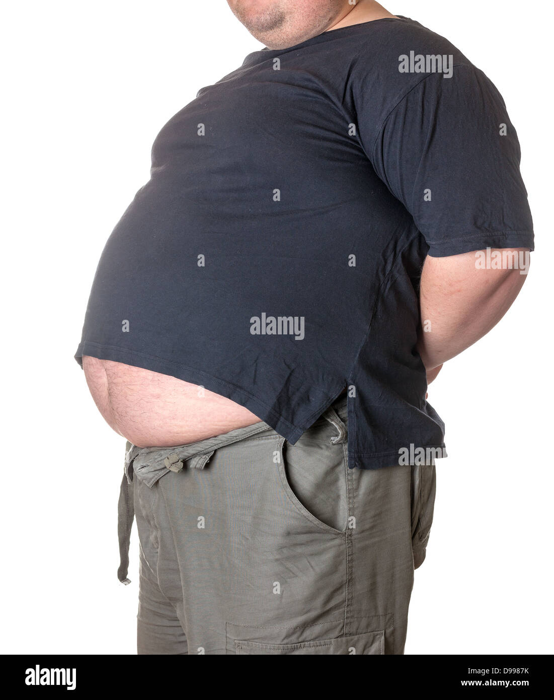 Dicker Mann mit einem dicken Bauch, close-up Teil des Körpers Stockfoto