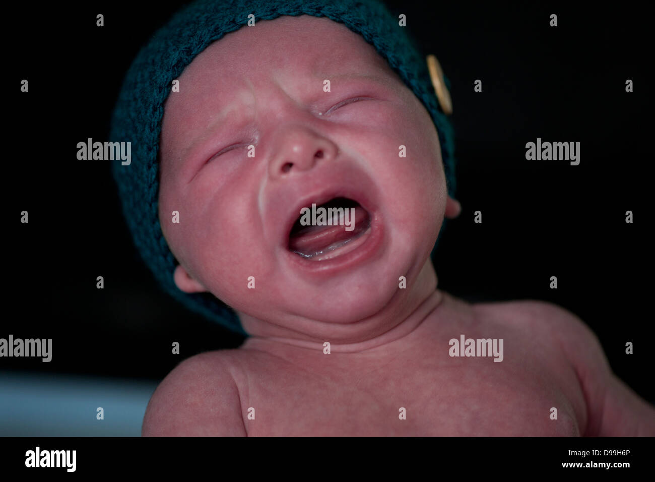 roter gegenübergestellte Neugeborenen Baby verärgert und Weinen Stockfoto