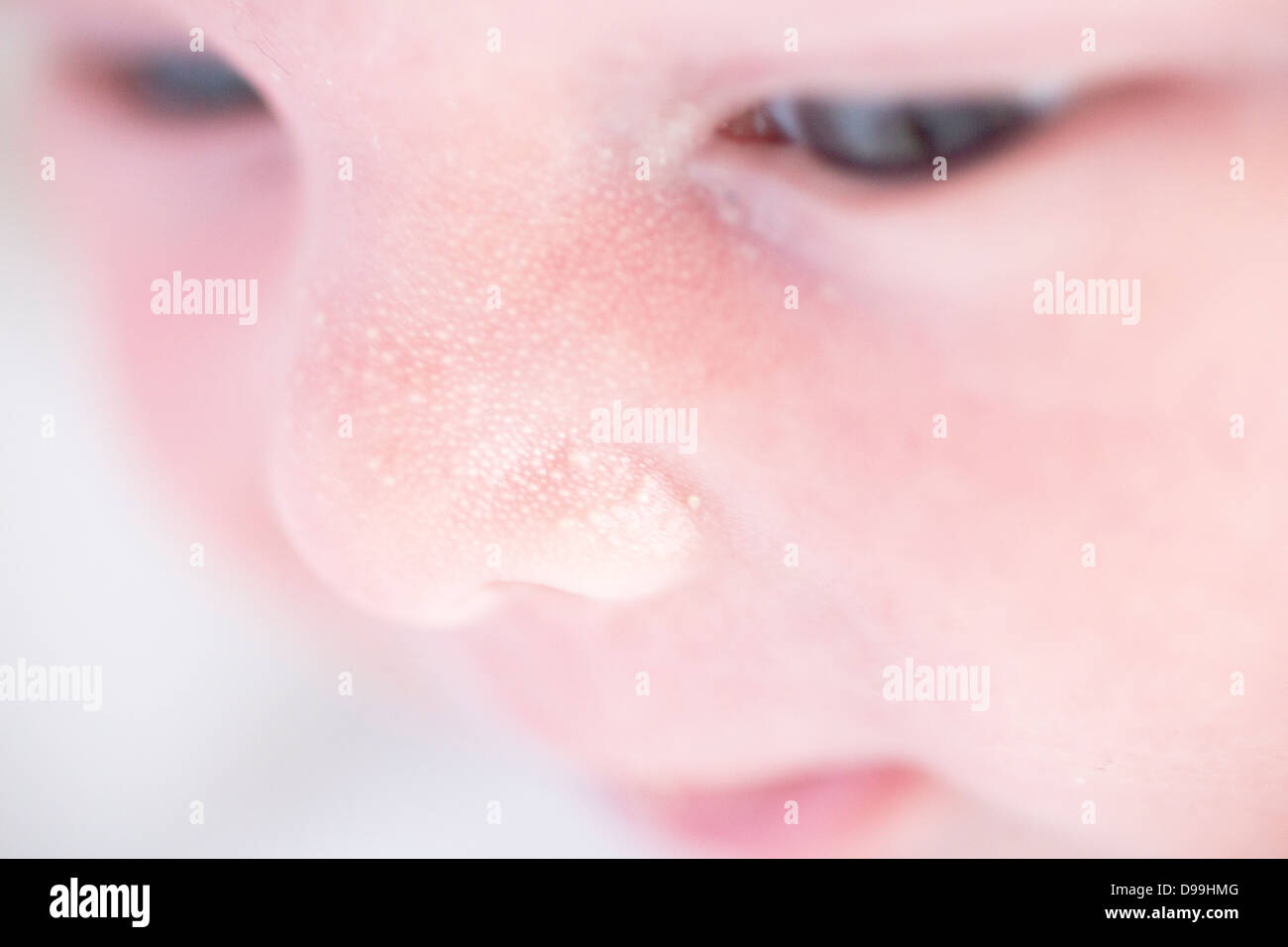 Nahaufnahme von Nase zeigt Milch Flecken Stockfoto