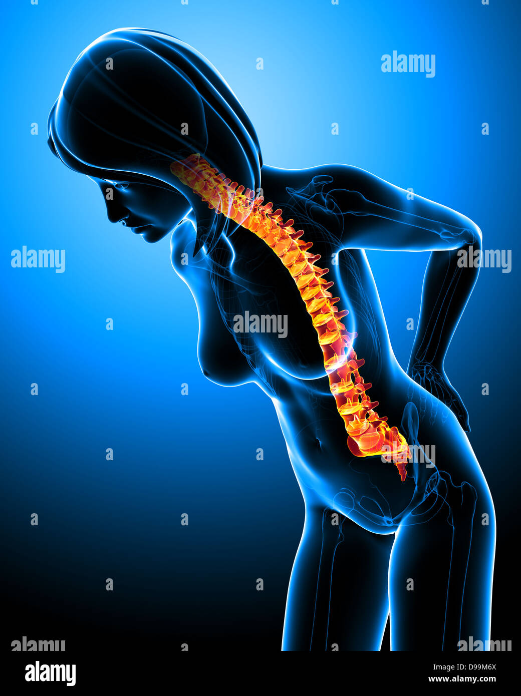 Anatomie der menschlichen Rückenschmerzen Stockfotografie - Alamy
