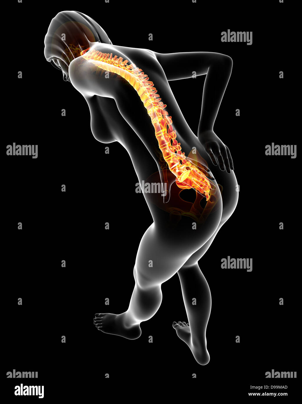 Anatomie der menschlichen Rückenschmerzen Stockfoto