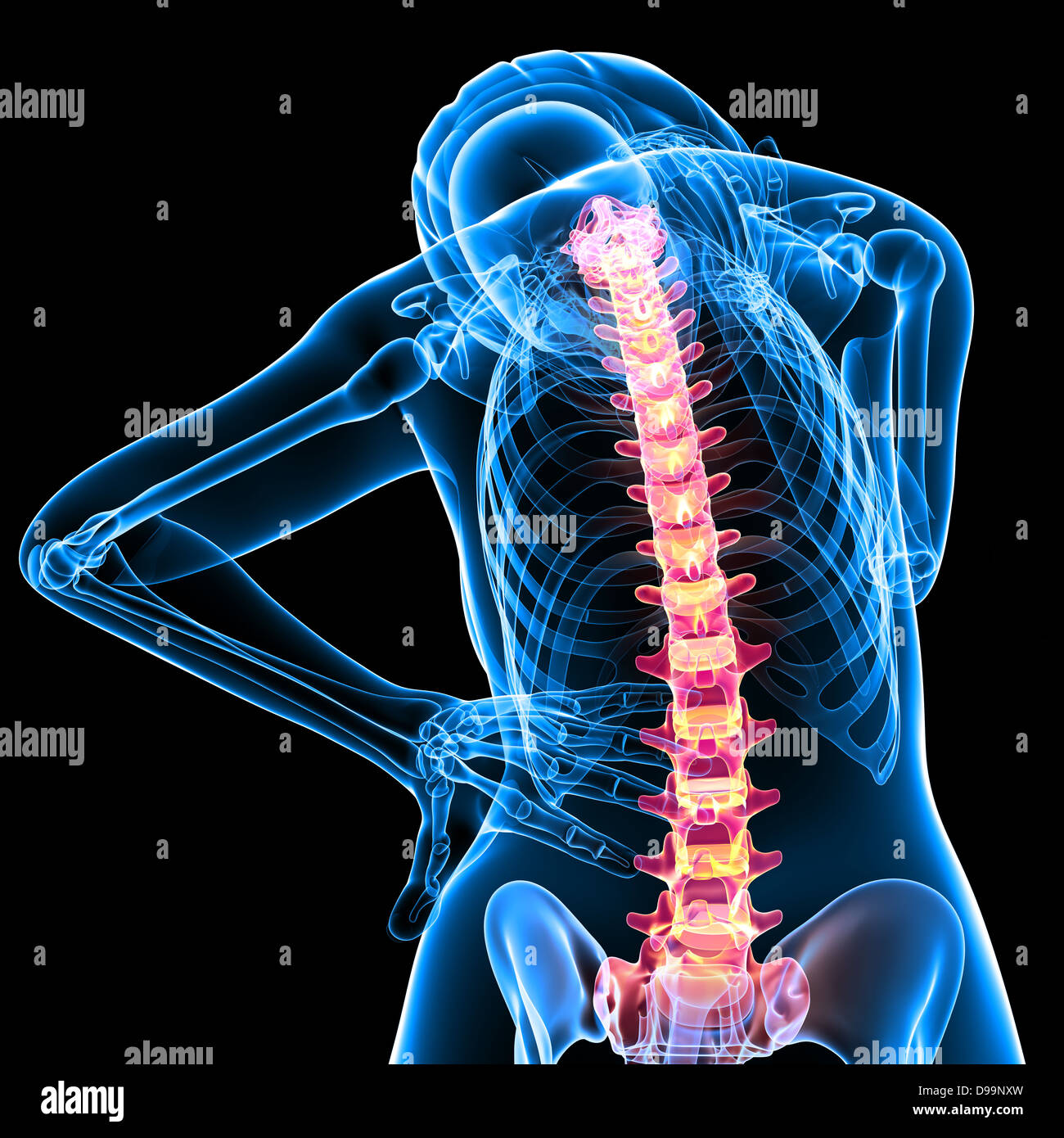 Anatomie der menschlichen Rückenschmerzen Stockfoto