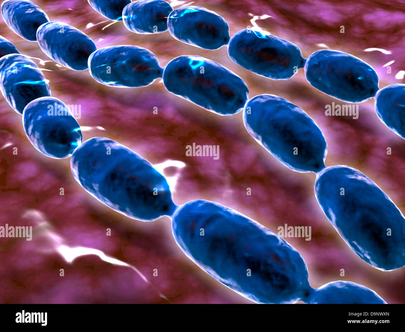 Mikroskopische Ansicht einer bakteriellen Lungenentzündung. Stockfoto