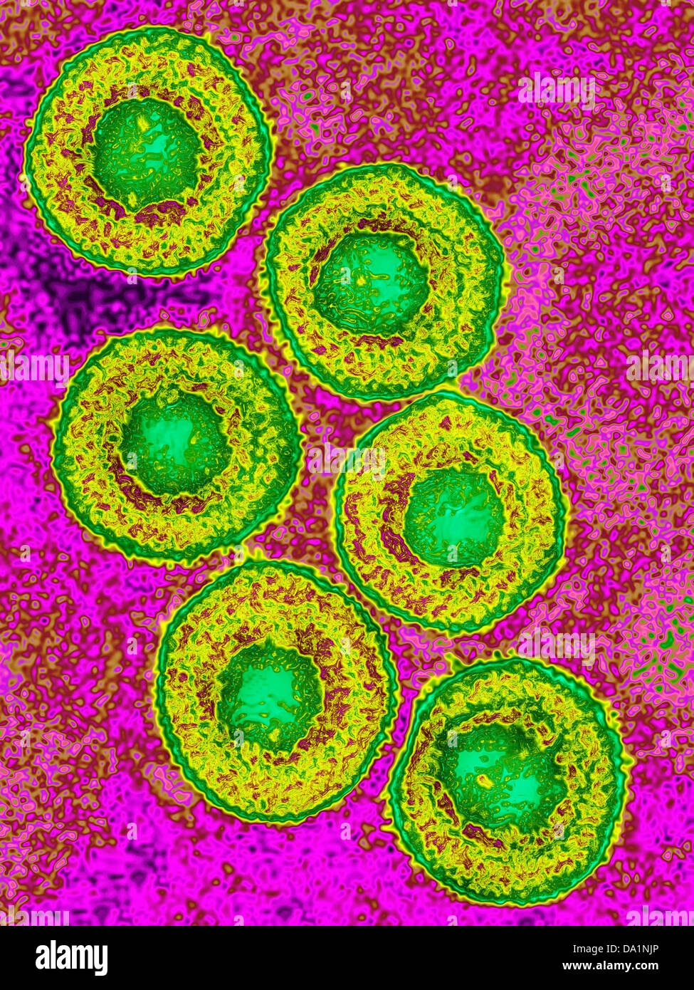 VARIZELLA-ZOSTER-VIRUS Stockfoto