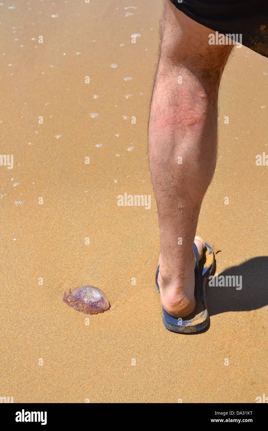 Jelly Fische Stachel auf Riviera Beach, Ghajn Tuffieha, Malta. Stockfoto