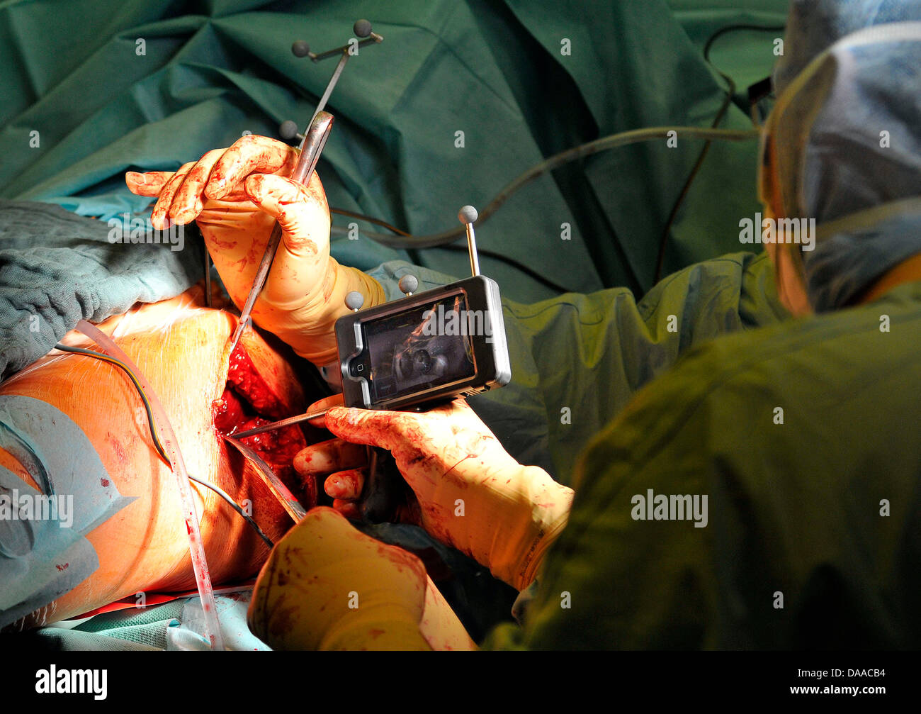 Hip Operation Hospital Stockfotos Und Bilder Kaufen Alamy