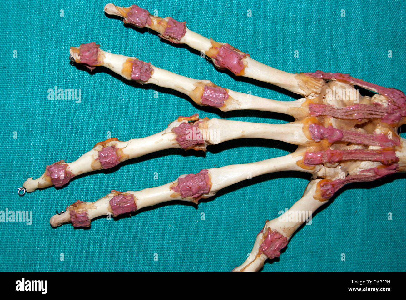 Menschliche Finger. Licht Schliffbild einen Längsschnitt durch einen Finger  eines menschlichen Kindes. Dies zeigt die Knochen in den Finger (hier sind  die 1. und Stockfotografie - Alamy