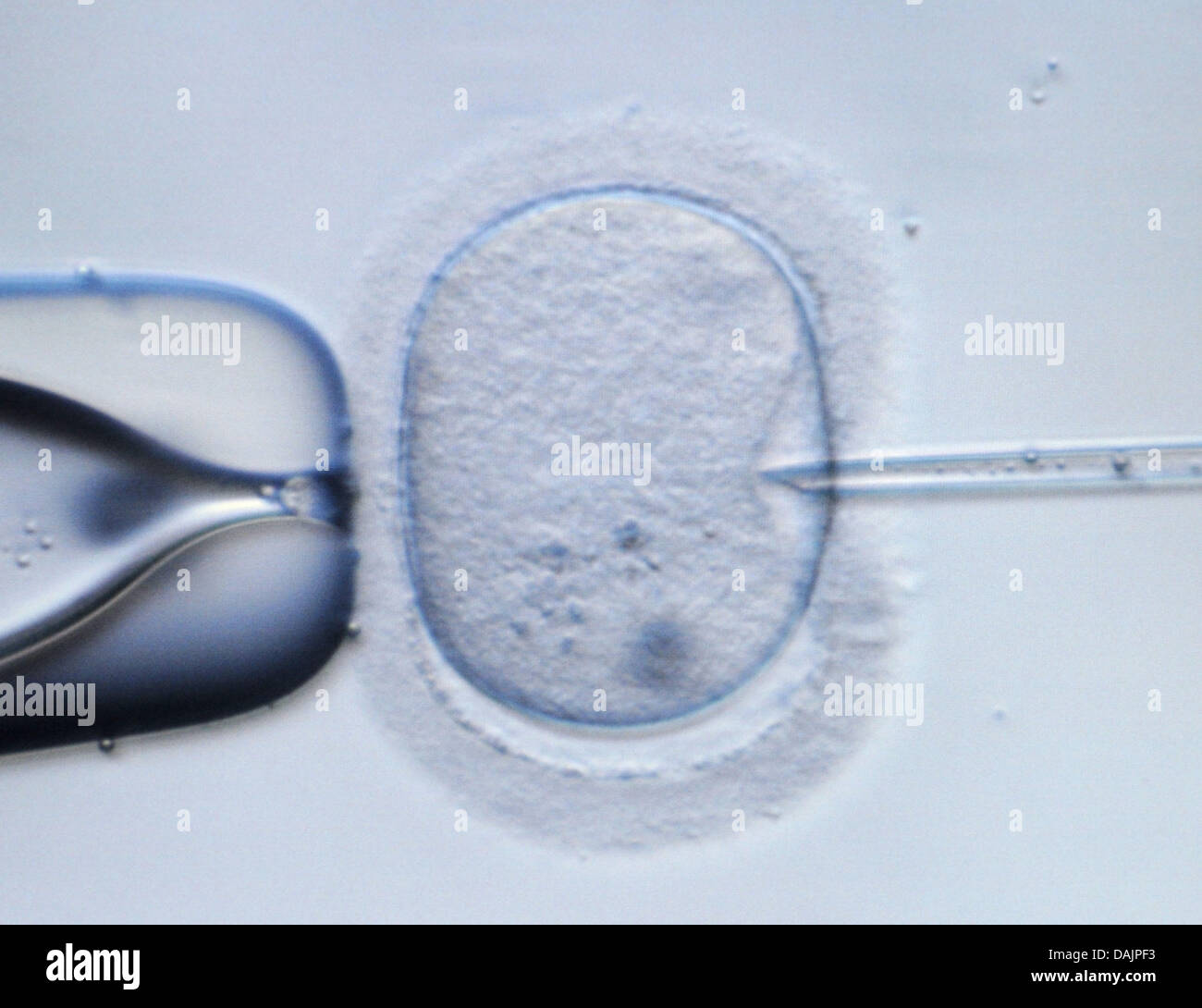() - ein Dpa-Datei Bild datiert 9. Februar 2009 zeigt eine mikroskopische Bild einer menschlichen Eizelle wird durch eine Injektionsnadel in einem Labor in Dresden, Deutschland punktiert. Die genetische Präimplantationsdiagnostik ist ein umstrittenes Thema in Deutschland. Foto: Ralf Hirschberger Stockfoto