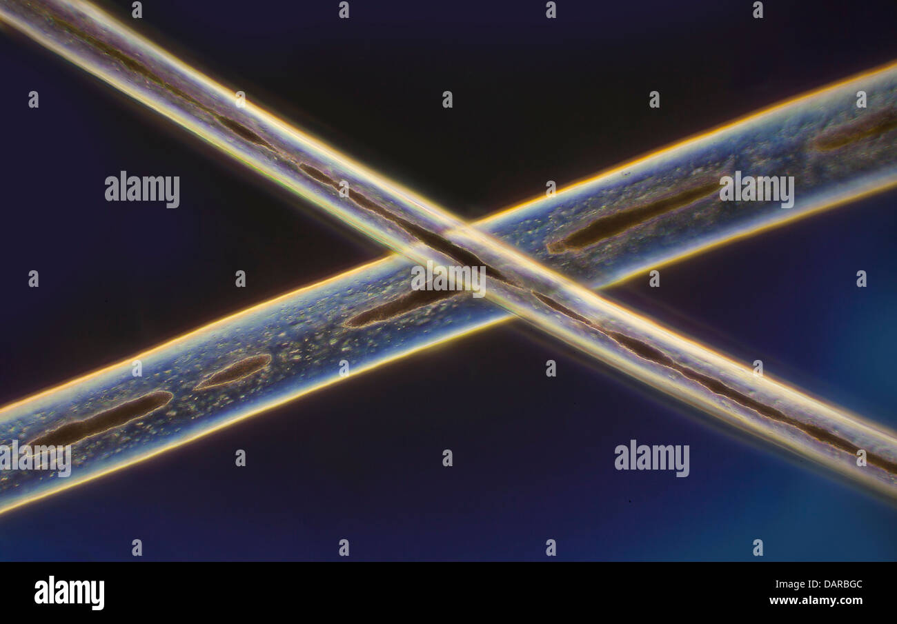 Dunkelfeld Mikrophotographie, menschliches Haar, Homo sapiens Stockfoto
