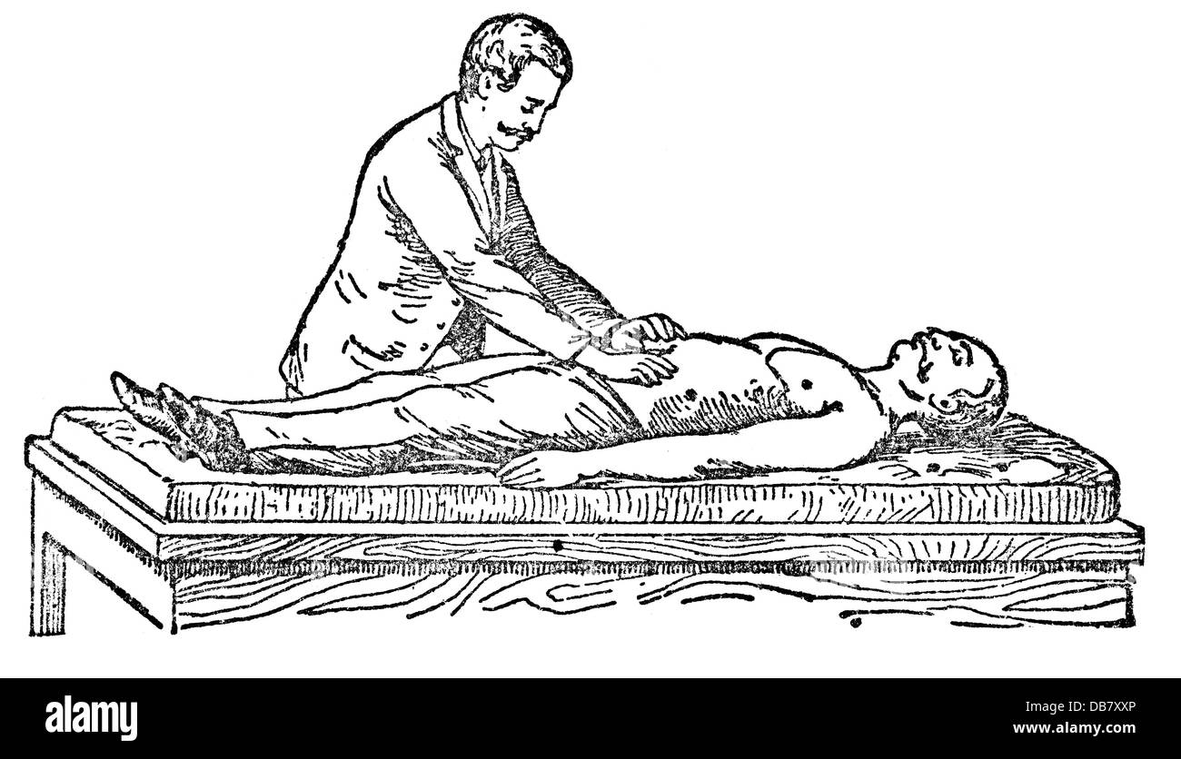 Medizin, Behandlung, Reanimationsversuch nach Dr. Frank, Holzstich, aus: Friedrich Eduard Bilz, Neue Naturheilkunde, Leipzig, Deutschland, 1902, Zusatzrechte-Clearenzen-nicht vorhanden Stockfoto