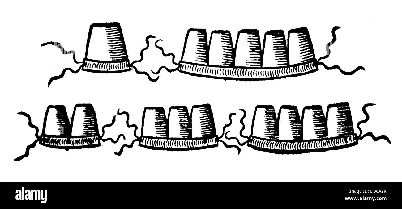 Medizin, Zahnmedizin, Zahnersatz mit Filament, Holzschnitt, aus: Ambroise Pare (um 1510 - 1590), 'Dix livres de la Chirurgie', Paris, 1545 - 1556, Privatsammlung, Zusatzrechte-Clearenzen-nicht vorhanden Stockfoto
