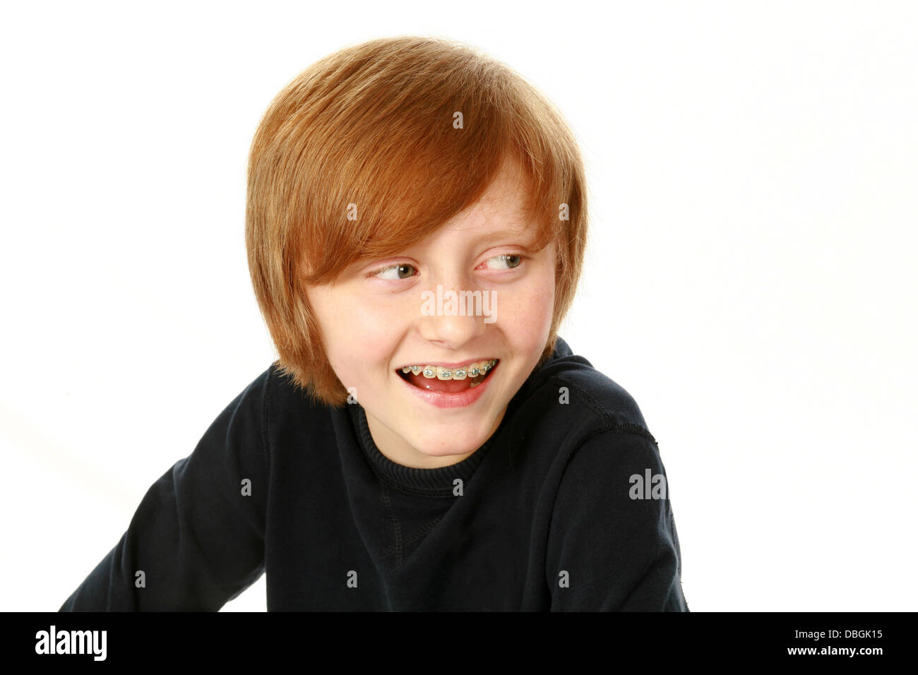 Porträt des Lächelns rothaarige junge mit geschweiften Klammern isoliert auf weiss Stockfoto
