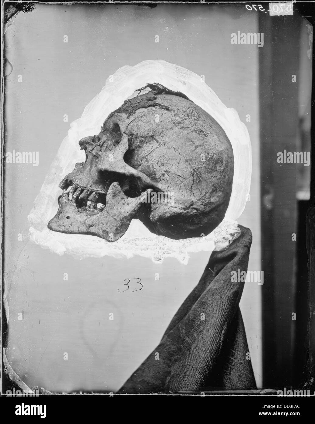 Ein detailliertes Bild eines Schädels, das von der linken Seite gezeigt wird und eine klare Sicht auf seine Struktur bietet. Das Bild wird für Ausbildungszwecke in anatomischen oder forensischen Studien verwendet, wobei der Schwerpunkt auf der Knochenstruktur liegt. Stockfoto