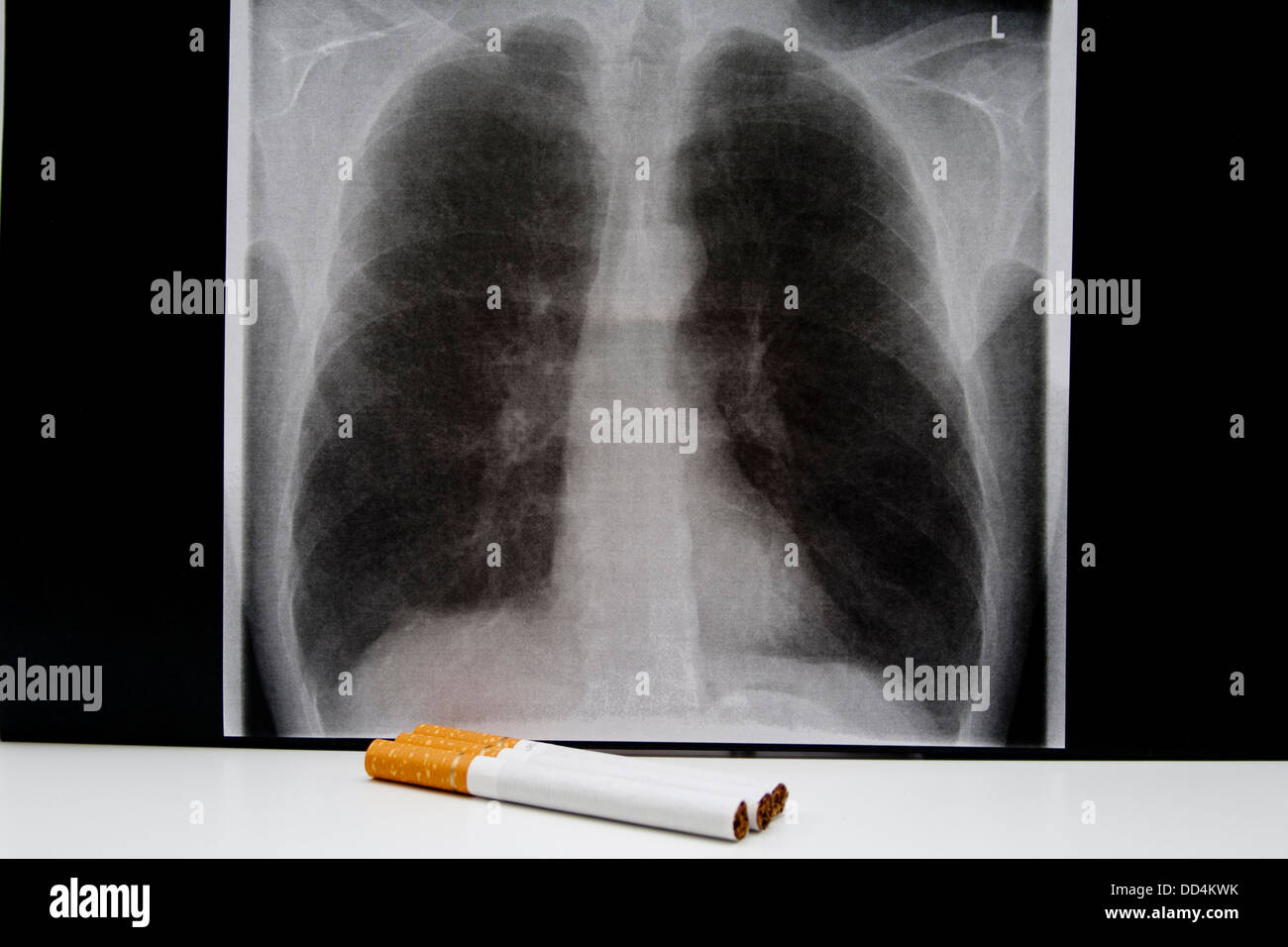 Lung Bild mit Zigaretten Stockfoto