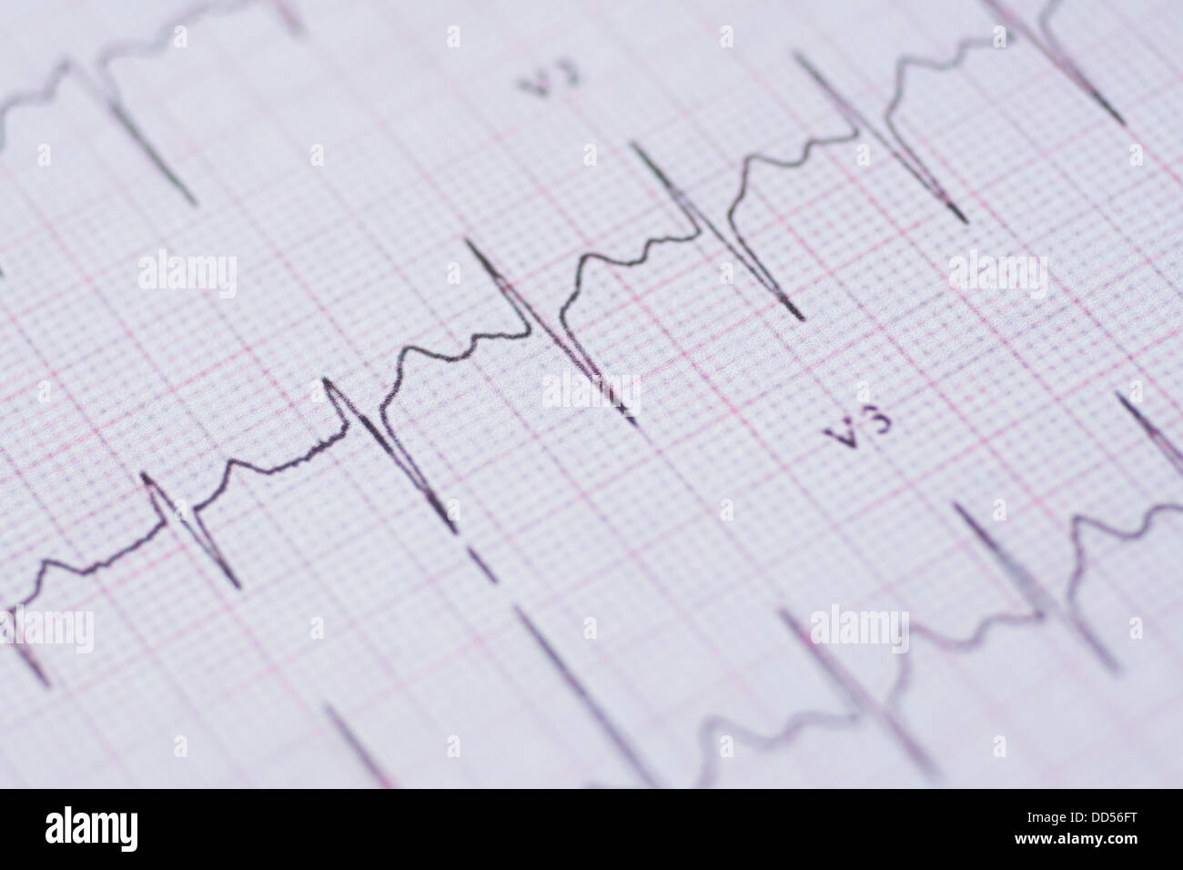 Ekg Ausdruck Stockfoto