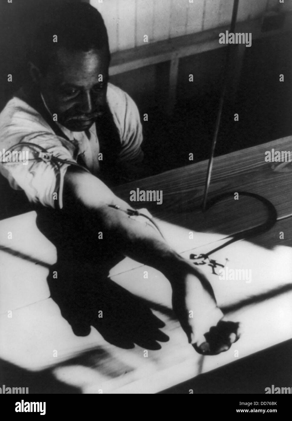 Afrikanische amerikanische Mann eine intravenöse Behandlung für Geschlechtskrankheiten, Georgia, ca. 1940. Behandlung für Syphilis war die Stockfoto