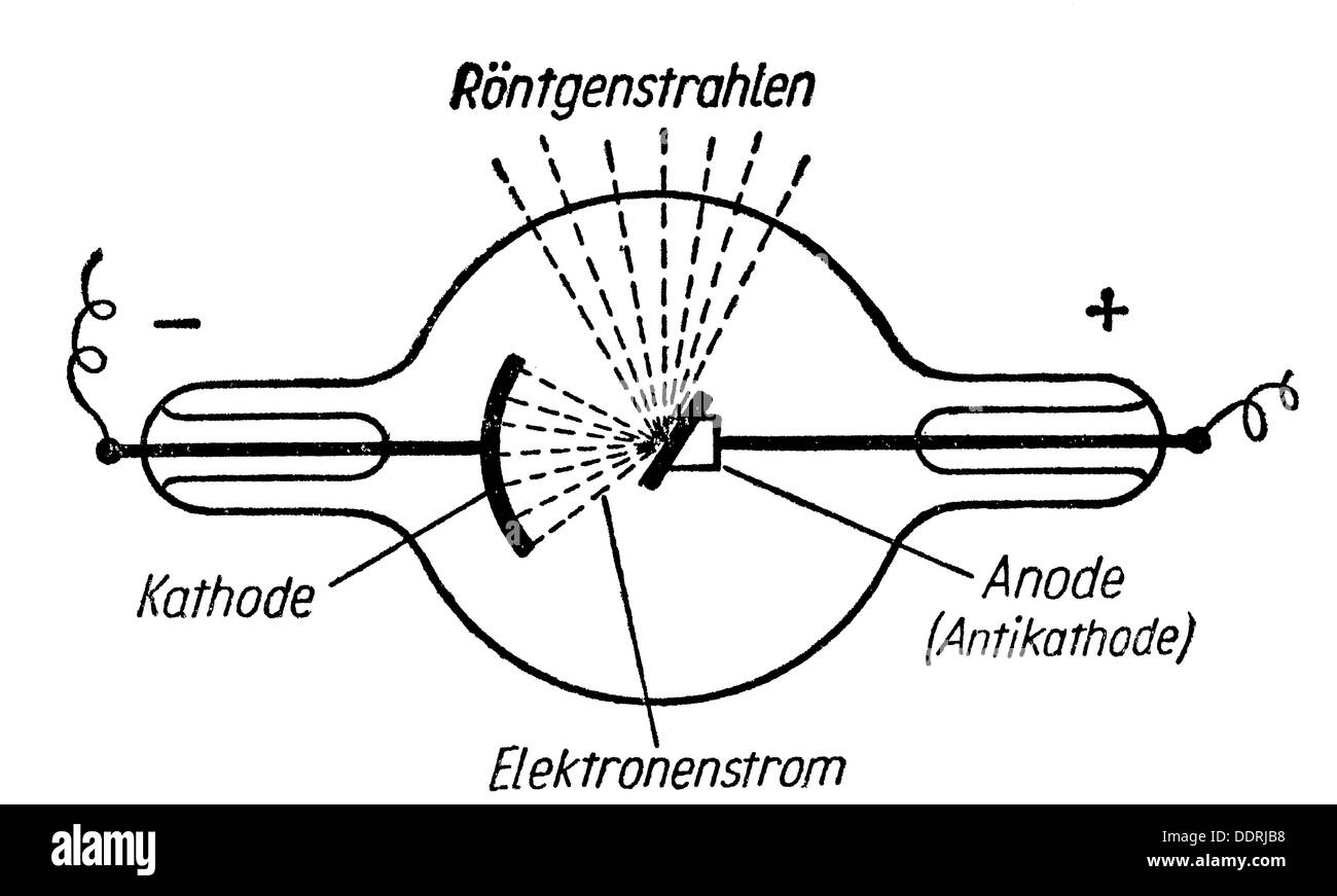 Medizin, Bestrahlung / Röntgen / Messung, schematische Darstellung über die Erzeugung von Röntgenstrahlen, Zeichnung, Grafik, Grafik, schematische Darstellung, Schema, Schemata, Skizze, Skizzen, Schablone, Templet, Schablonen, Templets, Röntgengerät, Röntgengerät, Röntgengeräte, Röntgengeräte, Kathoden, Anode, Anoden, Elektronenstrom, Röntgenstrahlen, Strahlentherapie, Medikamente, Röntgenbilder, Röntgenbilder, Röntgenbilder, Röntgenbilder, Röntgenbilder, Röntgenbilder, Röntgenbilder, Röntgenbilder Historische, historische, zusätzliche-Rechte-Clearences-nicht verfügbar Stockfoto