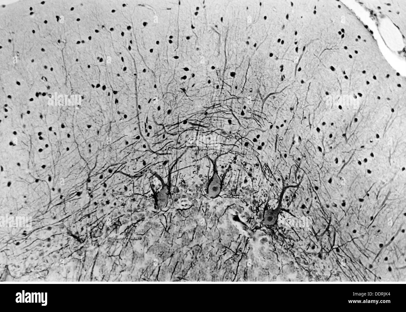 Hirnrinde des menschlichen kortex neural Schwarzweiß-Stockfotos und ...