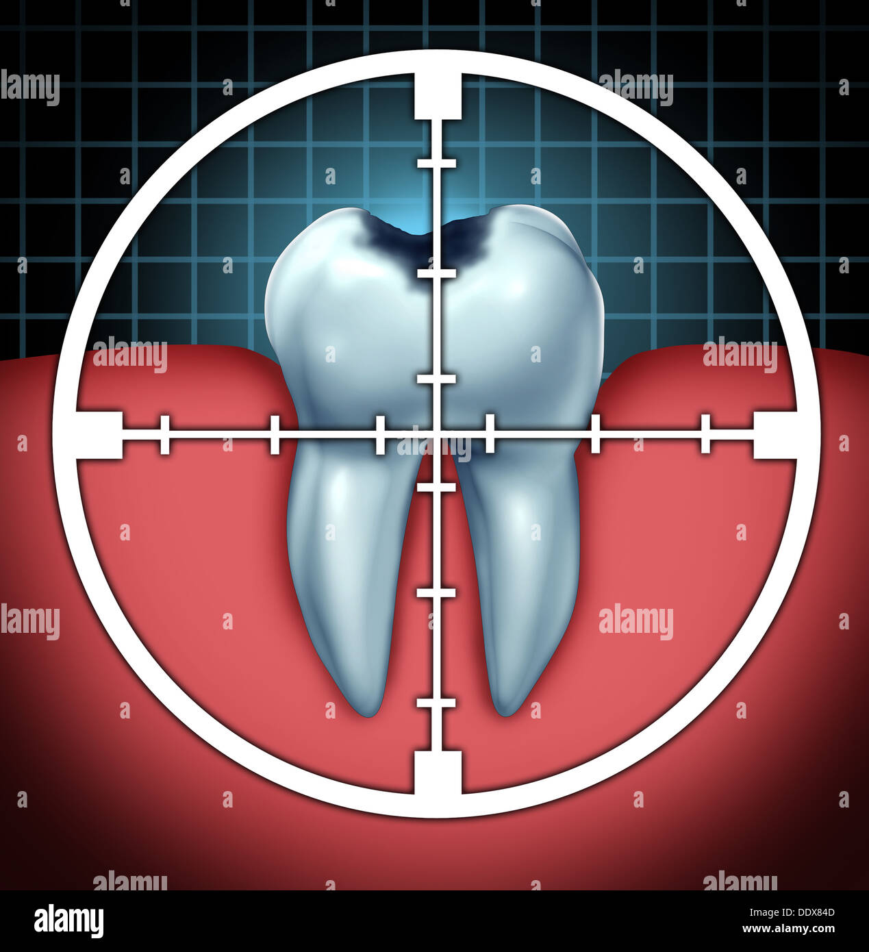 Kampf Hohlräume als einen Zahn Hohlraum hautnah Symbol mit einem Zielsymbol, mit dem Ziel der orale Erkrankung als health care Konzept zur Knochen Anatomie als Heilmittel und Zahnarzt Therapie gegen Zerfall und Fäulnis durch Bakterien und Säuren. Stockfoto