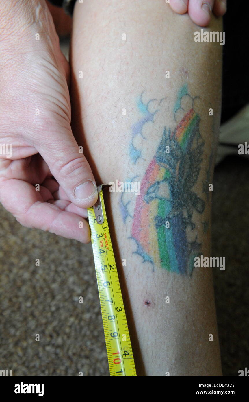 Swansea, Großbritannien. 8. September 2013. Im Bild: 47-jährige Cull Sue (Susan) zeigt die Bissspuren an den Beinen, in ihrer Wohnung in Swansea, Südwales. Montag, 9. September 2013 Re: eine Frau aus Swansea wurde ins Krankenhaus nach gebissen von einem Python auf ihrem Weg nach Hause von einem Curry-Restaurant. Sue (Susan) Cull wurde angegriffen, als Polizei die acht Fuß lange Schlange in Griffith John Street, im Bereich Dyfatty Jagd wurden. 47-Year-Old, nahm eine Abkürzung über den Rasen in der Nähe, wo sie lebte, als sie plötzlich eine stechende Gefühl auf beiden Beinen spürte. Bildnachweis: D Legakis/Alamy Live-Nachrichten Stockfoto