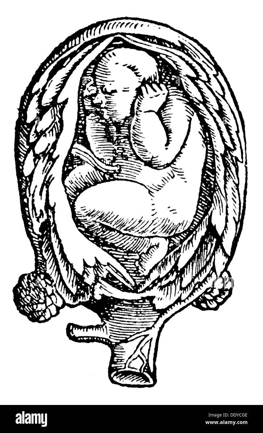 Medizin, Geburt / Gynäkologie, Lage des Embryos im Mutterleib, Holzschnitt, aus: Jakob Ruf (1505 - 1558), 'Trostbüchlein', Druck: Christoph Froschauer, Zürich, 1554, Additional-Rights-Clearences-not available Stockfoto