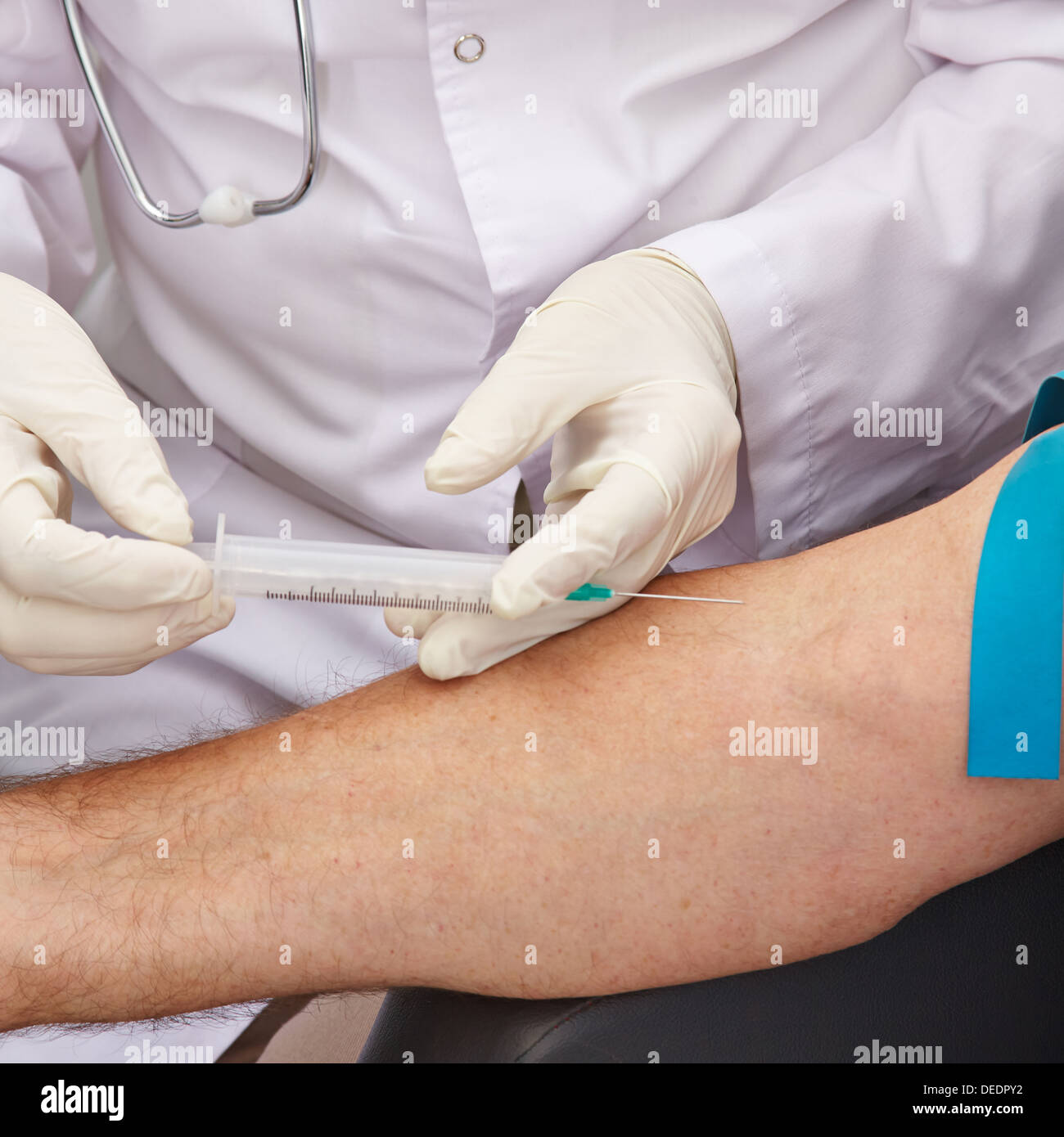 Blut-Entnahme am Arm mit Spritze während einer Blutspende in einem Krankenhaus Stockfoto
