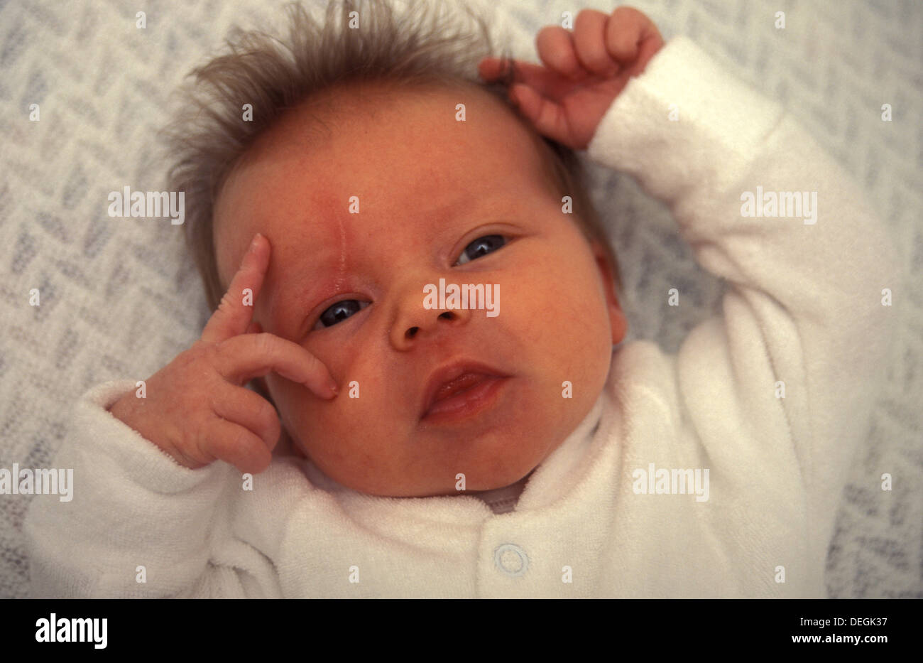 neugeborenes Baby hat Gesicht aufgrund der scharfen Fingernägeln zerkratzt. Stockfoto