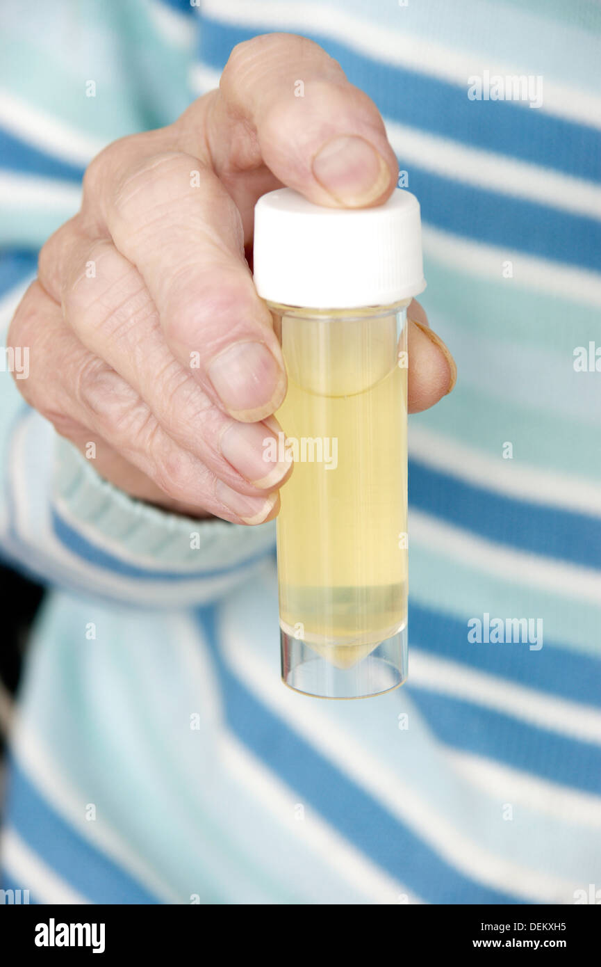 Ältere Frau mit einem sterilen universal-Container mit einer Urinprobe bereit für die Analyse Stockfoto