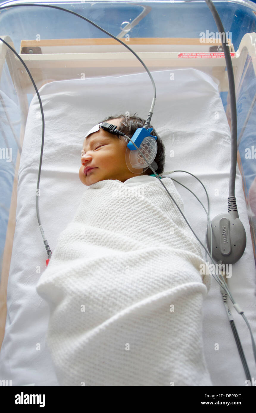 Neugeborenen-Screening Hörtest Auditory Brainstem Response Stockfoto