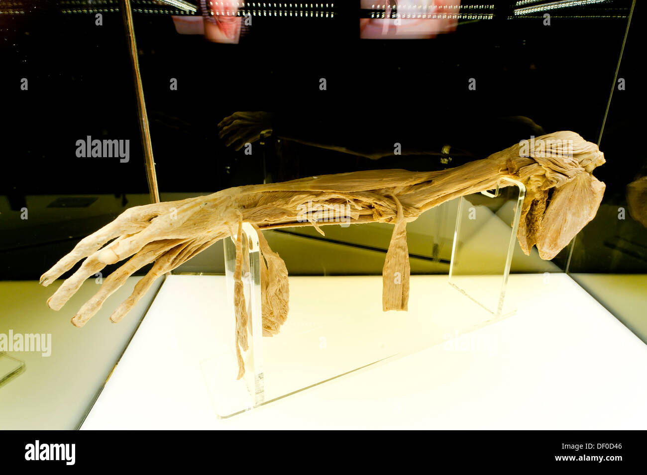 Plastination Exemplar der oberen Extremität Dissektion Stockfoto