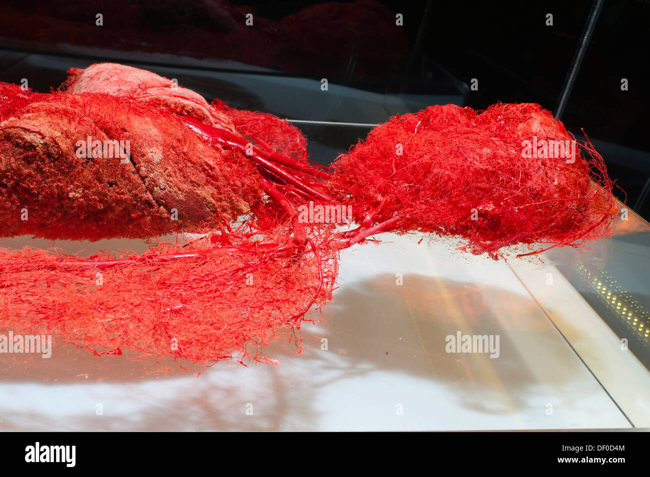 Plastination Exemplar der Arterien des Oberkörpers Stockfoto