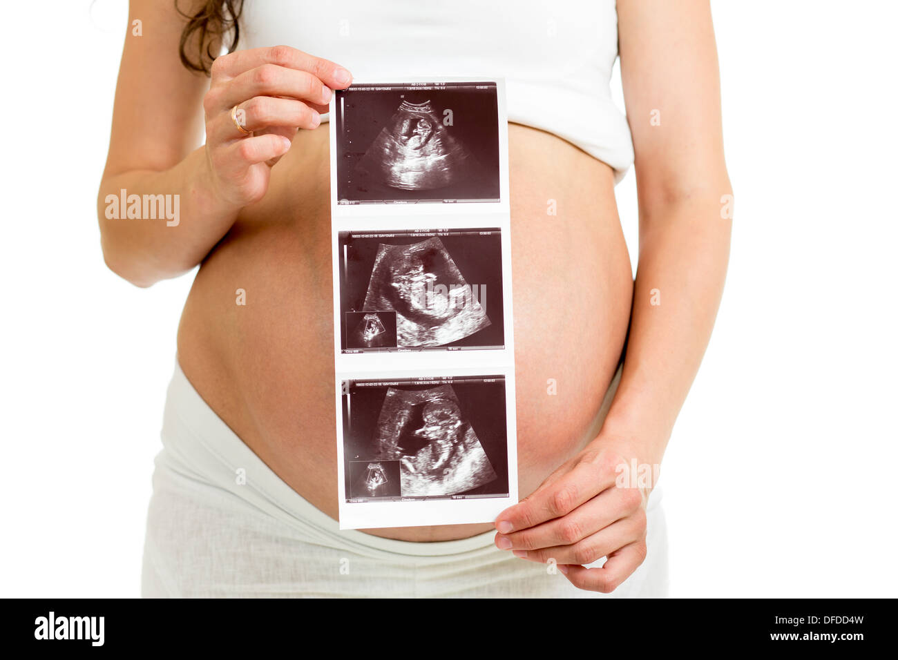 Schwangere Frau mit Ultraschall auf ihrem Bauch Stockfoto